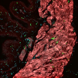 square ClatworthyBladder