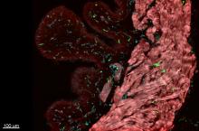 confocal imaging of bladder dendritic cells