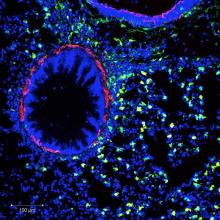 IL 33CIT lung slices