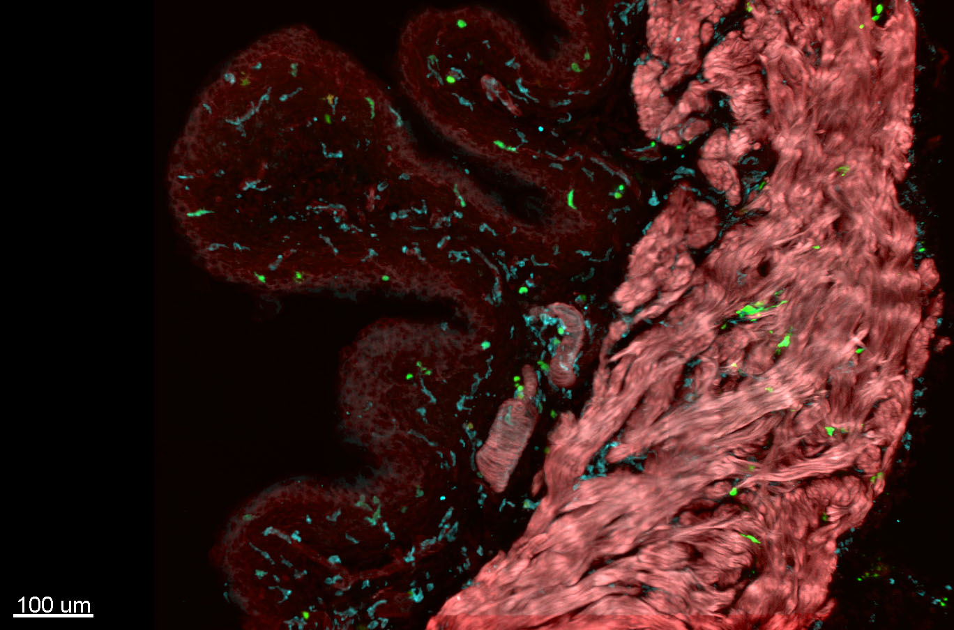confocal imaging of bladder dendritic cells