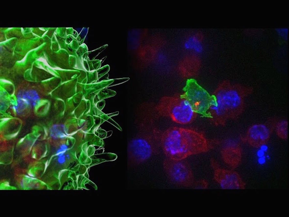 Клетки т 8. Раковые клетки и клетки киллеры. Гибрид раковой клетки и. Т-клетка уничтожает раковую клетку. Клетка борющаяся с паразитами.