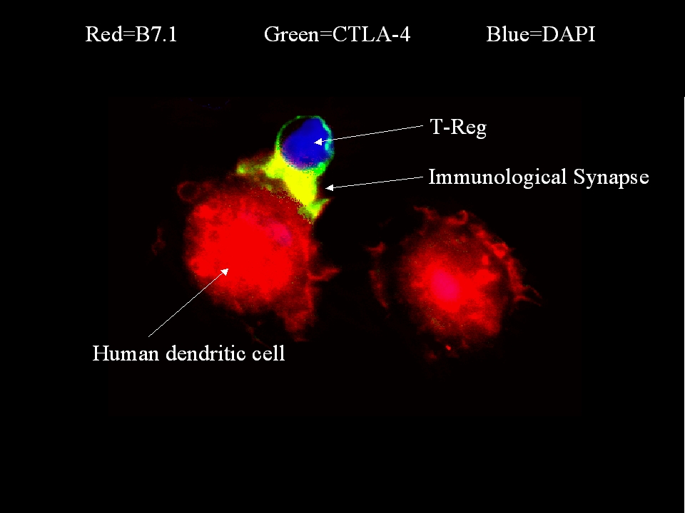 Interaction of a human T regulatory cell and dendritic cell involving the type 1 diabetes susceptibility molecule, CTLA-4. Yellow = B7.1+CTLA4. Photograph reproduced with kind permission from Paul MacAry
