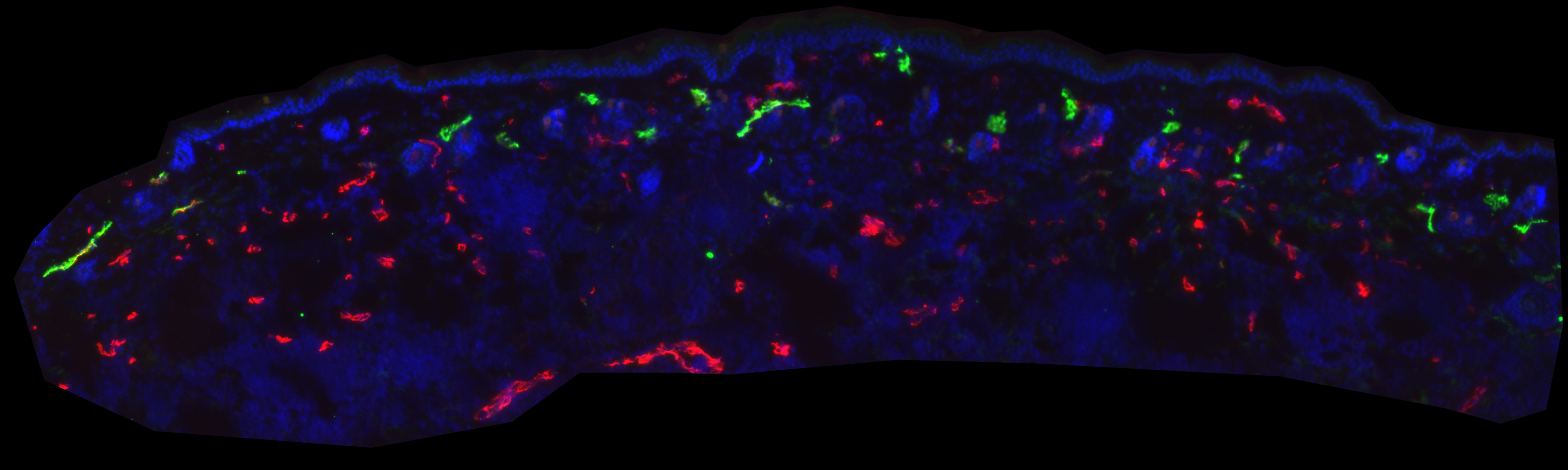Lymphatic vessels in skin labelled with LYVE-1 (green), CD31 (red), DAPI (blue)