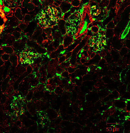 Kidneys from old autoimmune prone mice have been stained for laminin (red) to highlight the tubular organisation and for IgG (green). Immune complex deposition in the glomeruli and infiltrating plasma cells in the tubuloinsterstitium can be observed. by M