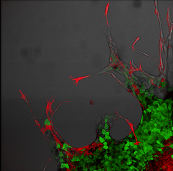 The interface of a 3D cancer-associated fibroblast-tumour spheroid and surrounding extracellular matrix. Red labelled fibroblasts can be seen leading invasion of green tumour cells into the surrounding matrix