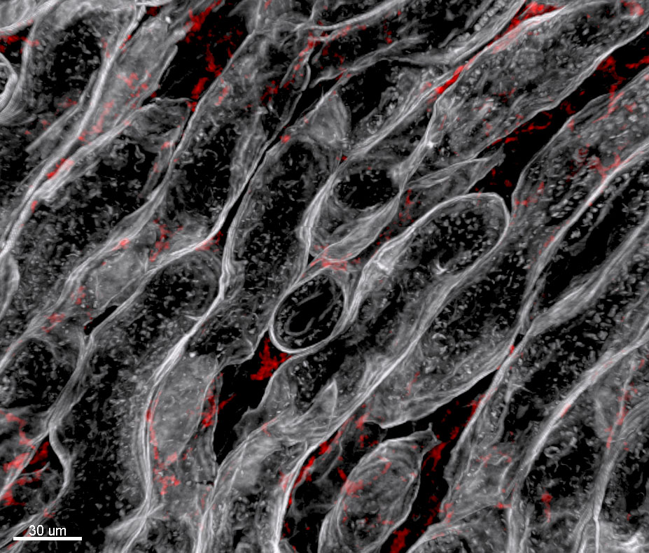 renal tubular cells