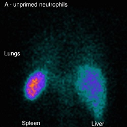 Unprimed neutrophil small